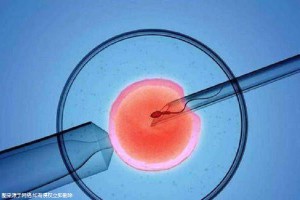 关于助孕借卵试管机构